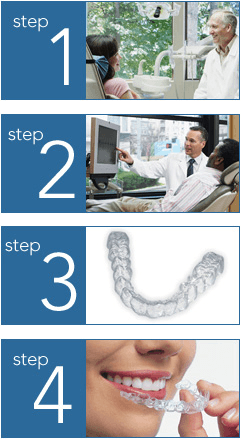 Invisalign Treatment Steps